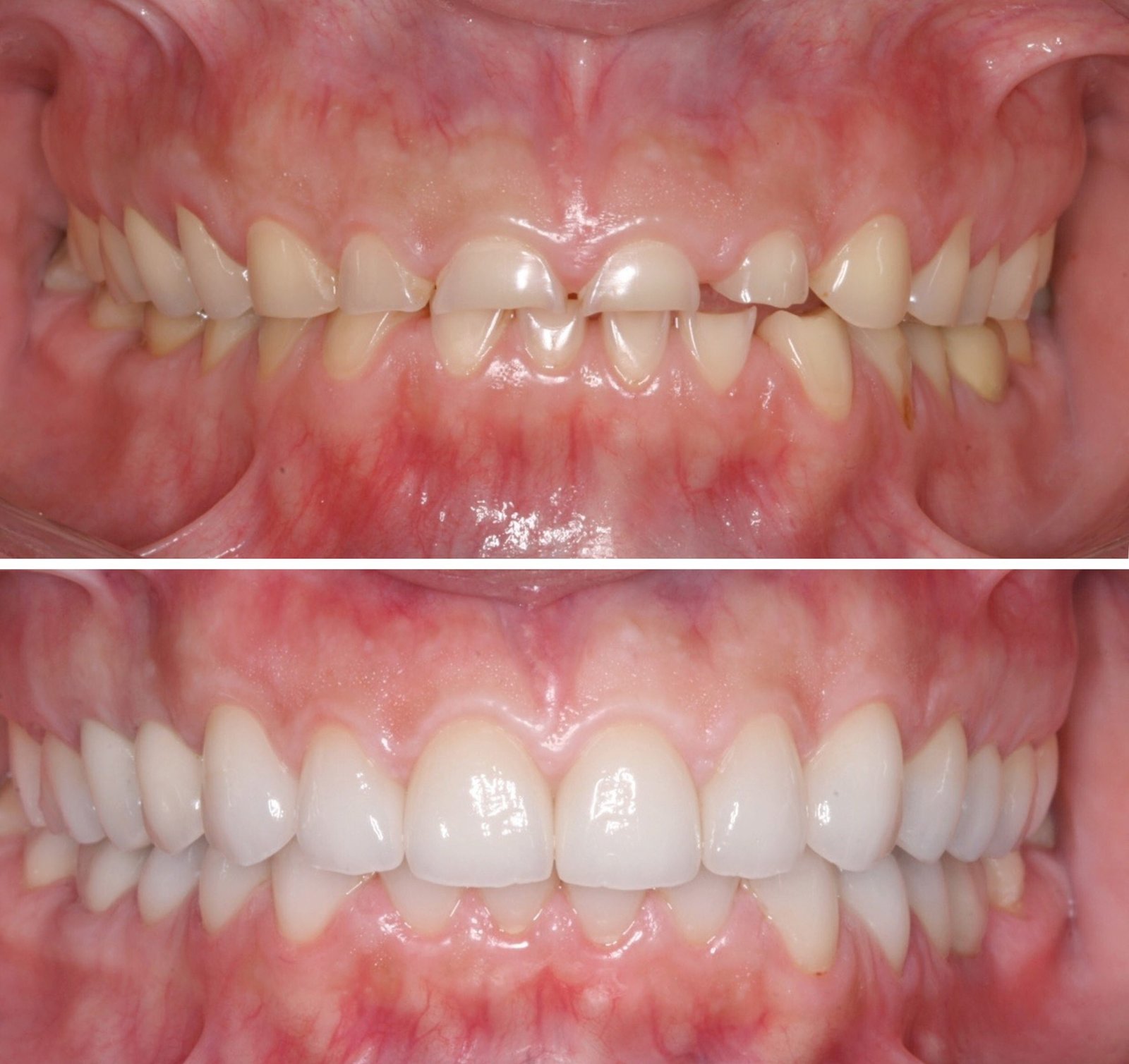 FMR-Case-2-Vasillios-scaled (1)