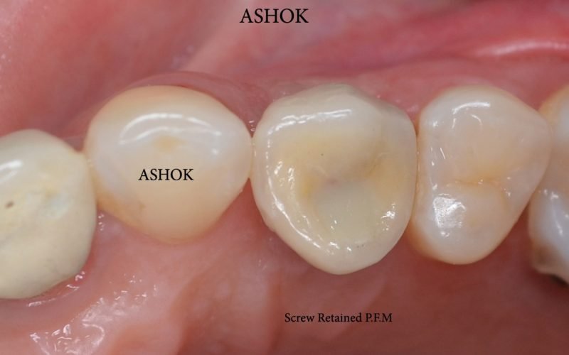 WhatsApp Image 2025-08-07 at 11.48.46 (1)