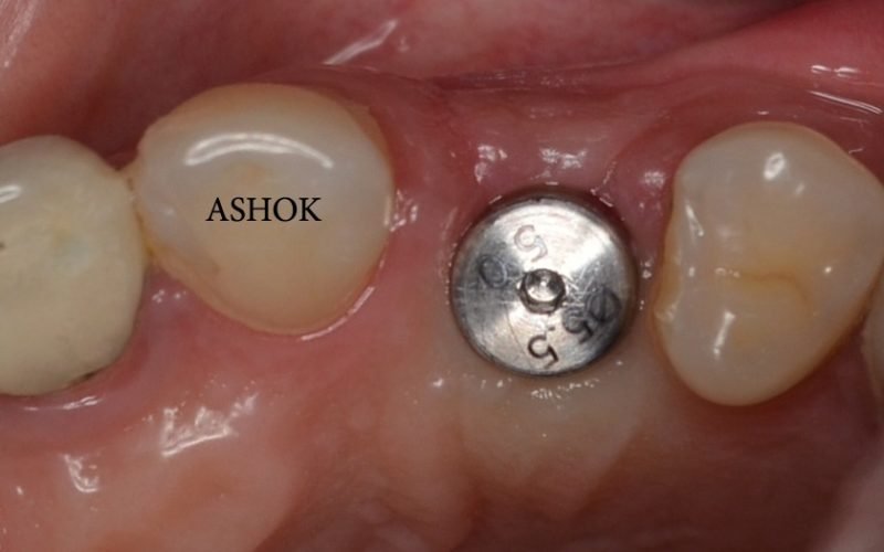 WhatsApp Image 2025-08-07 at 11.48.46